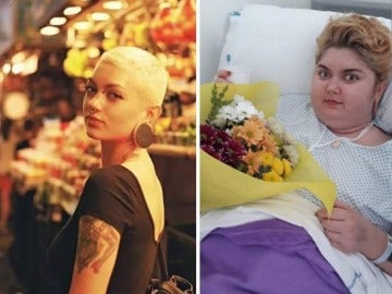 Ana antes y después de la enfermedad Ana antes y después de la enfermedad