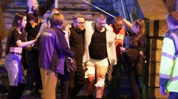 Heridos tras las explosiones en el Manchester Arena