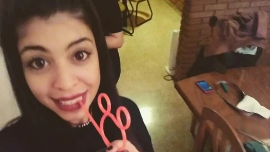 Berenice antes de la operación Berenice antes de la operación