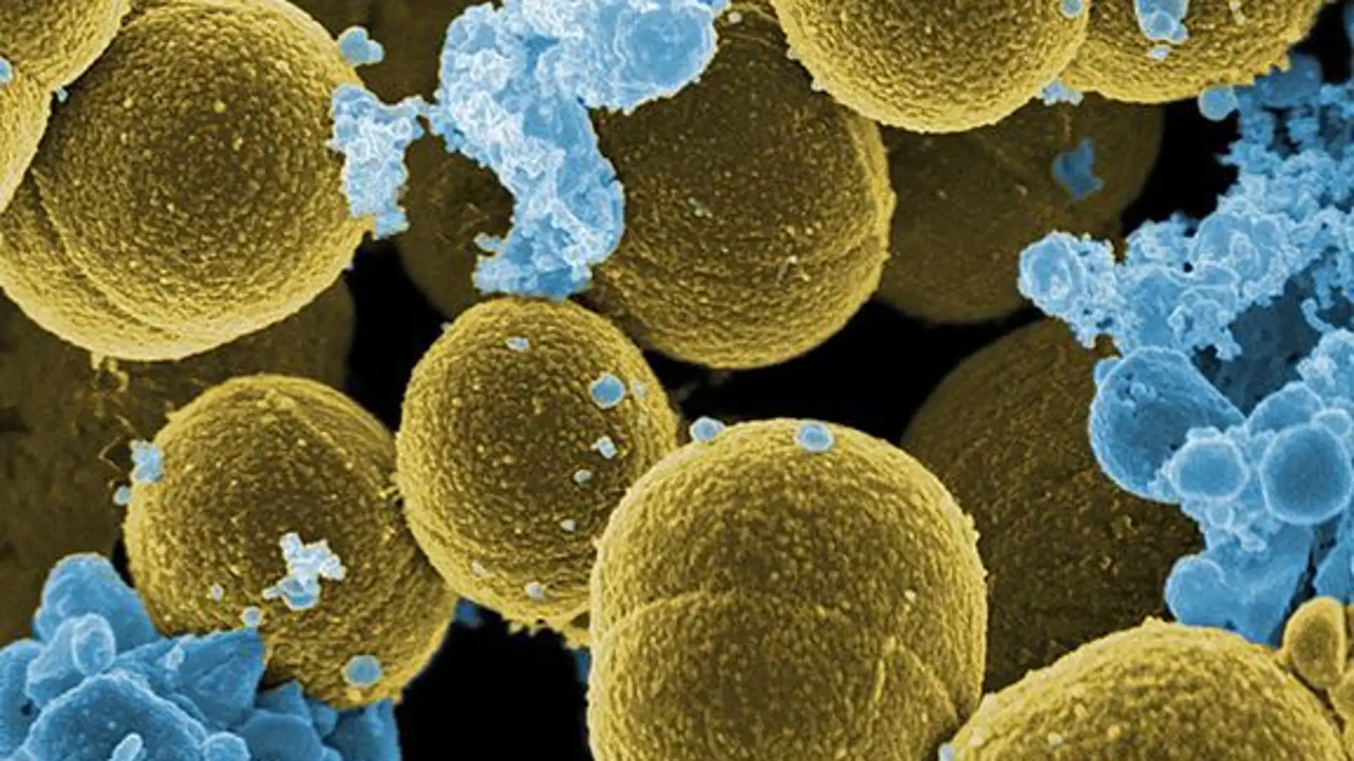 Como es el ciclo de vida de los virus que infectan Staphylococcus aureus