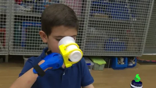 'SuperGiz', la nueva prótesis mecánica con tecnología 3D 'SuperGiz', la nueva prótesis mecánica con tecnología 3D