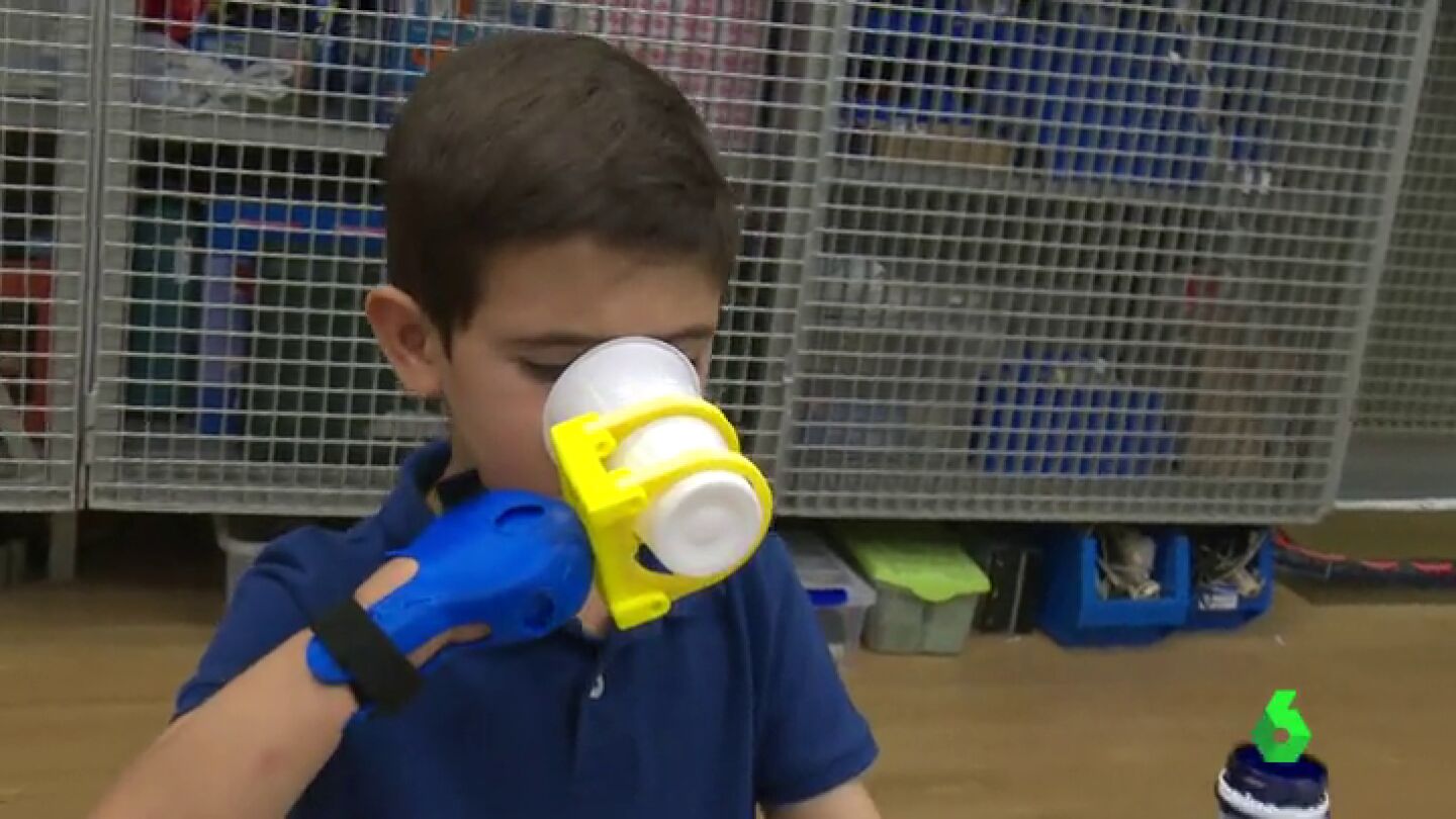 'SuperGiz', la nueva pr&oacute;tesis mec&aacute;nica con tecnolog&iacute;a 3D 