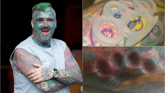 El puño americano de Matthew Whelan, el hombre con más tatuajes de Reino Unido El puño americano de Matthew Whelan, el hombre con más tatuajes de Reino Unido