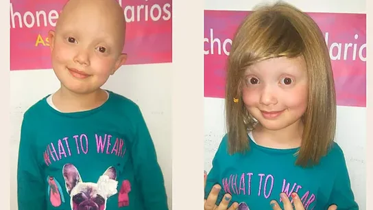 Peluca de Mechones solidarios Peluca de Mechones solidarios