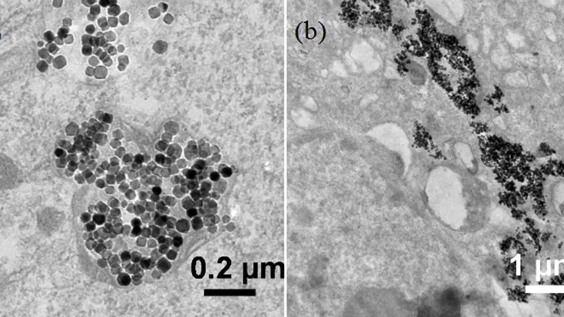 Agregados de nanoparticulas destruyen celulas cancerosas