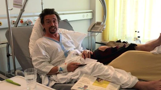 El presentador Richard Hammond en el hospital tras el accidente