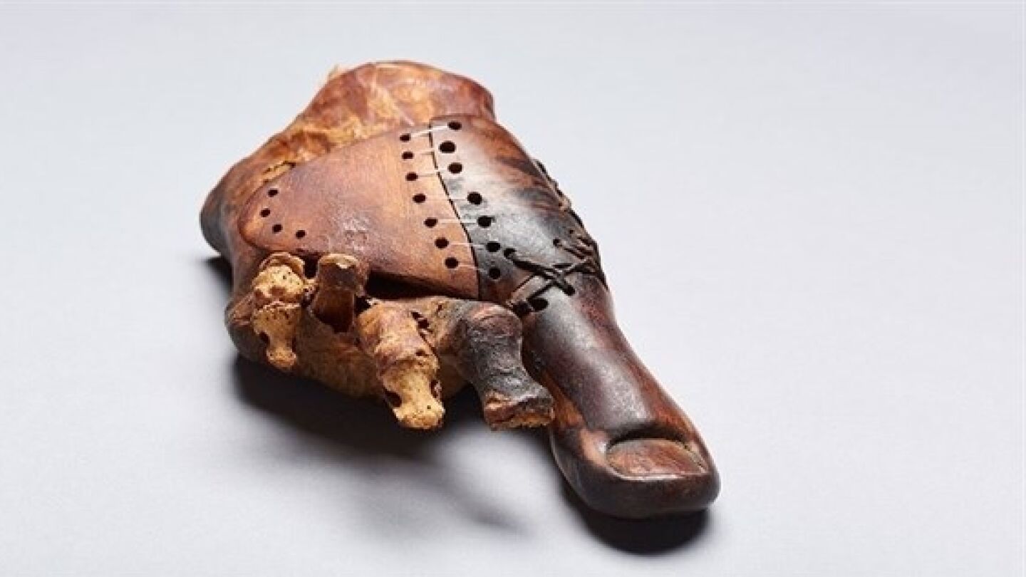 Dedo prot&eacute;sico encontrado en Egipto