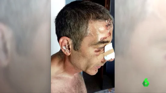 Recibe una paliza al intentar evitar una agresión machista Recibe una paliza al intentar evitar una agresión machista