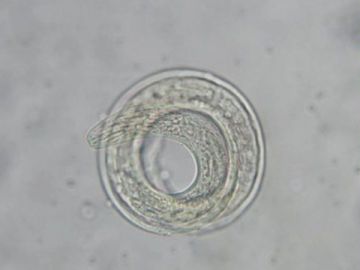 Angiostrongylus cantonensis Angiostrongylus cantonensis