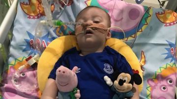 Alfie Evans, intubado en el hospital