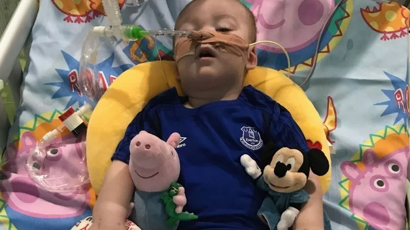 Alfie Evans, intubado en el hospital