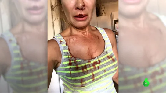 mujer perros mujer perros