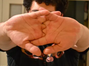 Acto de crujir los nudillos Acto de crujir los nudillos