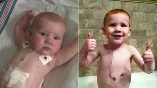 La recuperaci&oacute;n de Jack tras ser operado tres veces a coraz&oacute;n abierto