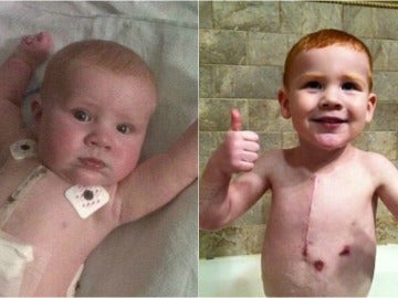 La recuperación de Jack tras ser operado tres veces a corazón abierto La recuperación de Jack tras ser operado tres veces a corazón abierto