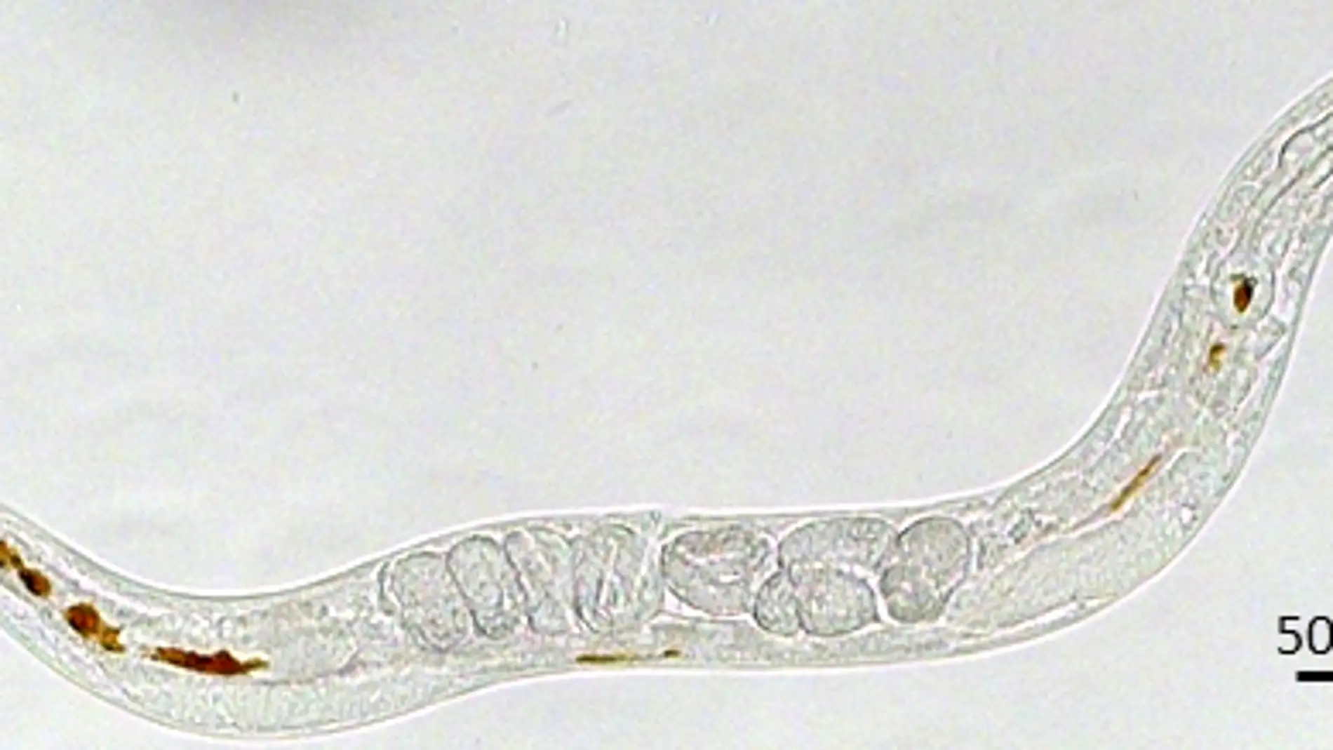 Las nanoparticulas de oxido de hierro estresan a las celulas