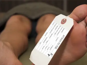 Funciones que el cuerpo humano sigue realizando después de morir Funciones que el cuerpo humano sigue realizando después de morir