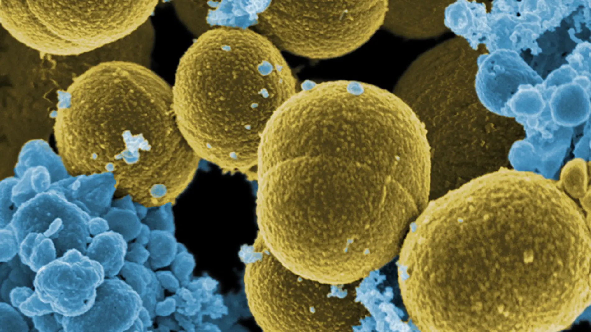 La importacion ilegal de alimentos ayuda a propagar una peligrosa bacteria