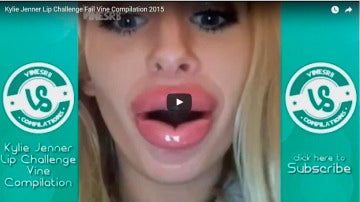 Kylie Jenner Lip Challenge