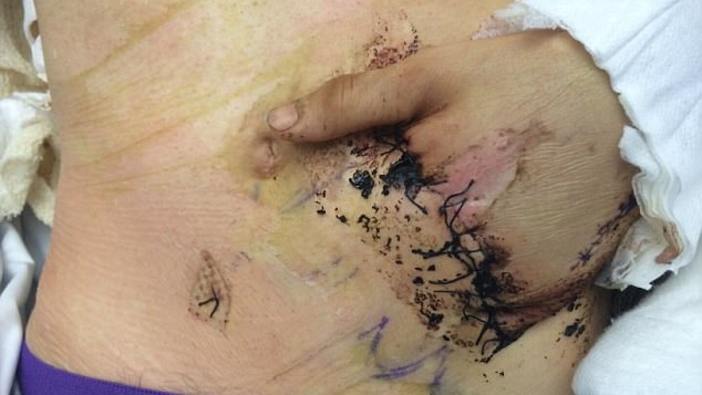 La mano de Anthony Seward dentro de su vientre