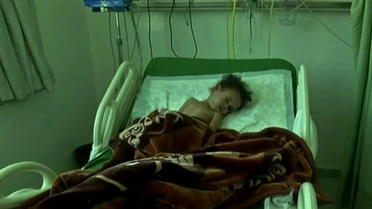 Única superviviente de una familia de los bombardeos de Yemen Única superviviente de una familia de los bombardeos de Yemen