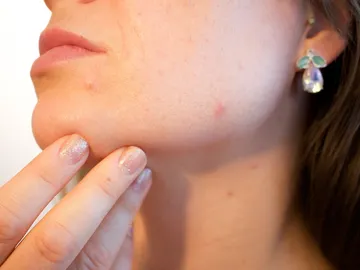 Tratamiento facial Tratamiento facial