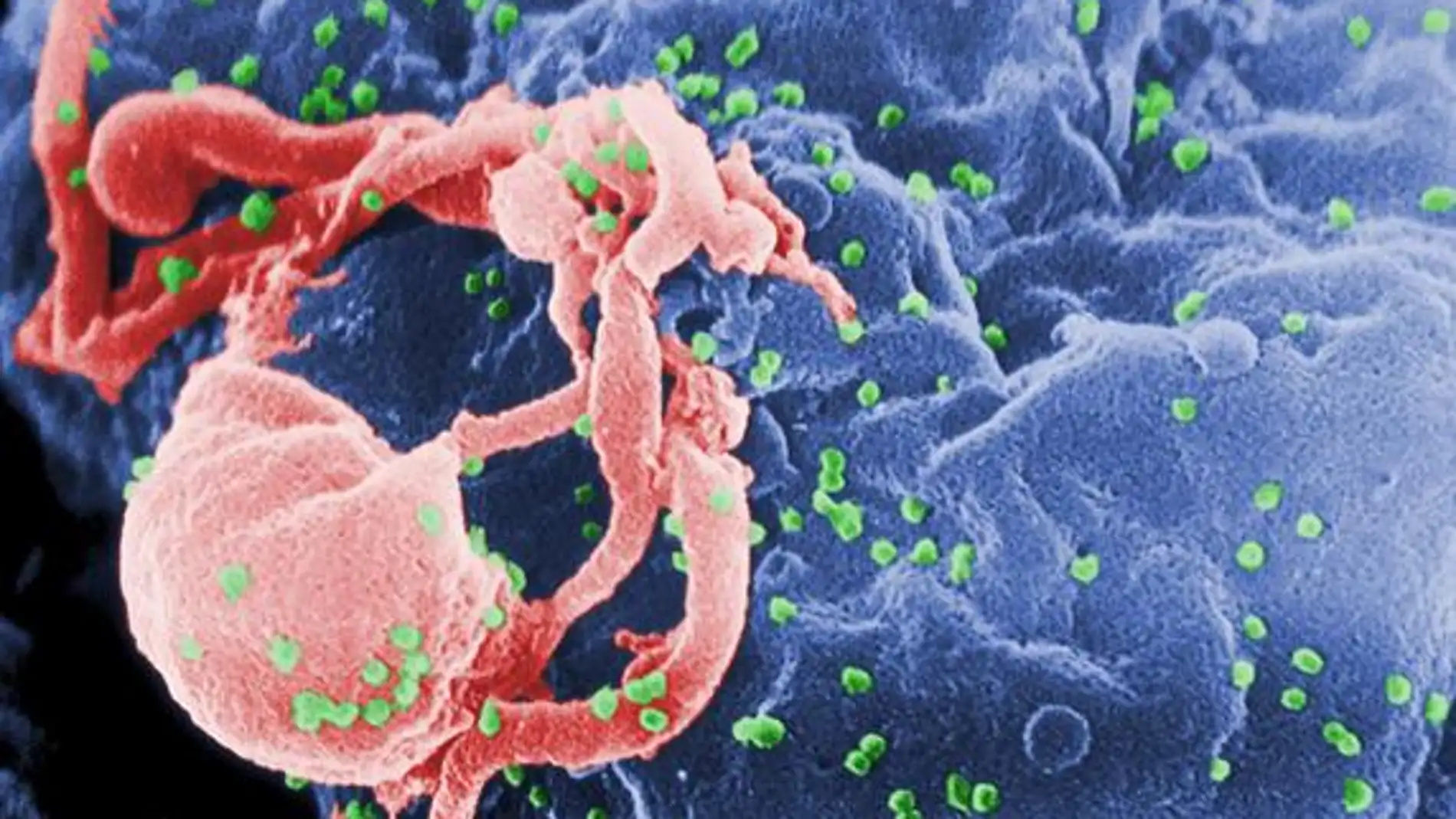 Una proteina capaz de facilitar el diagnostico de VIH en paises pobres