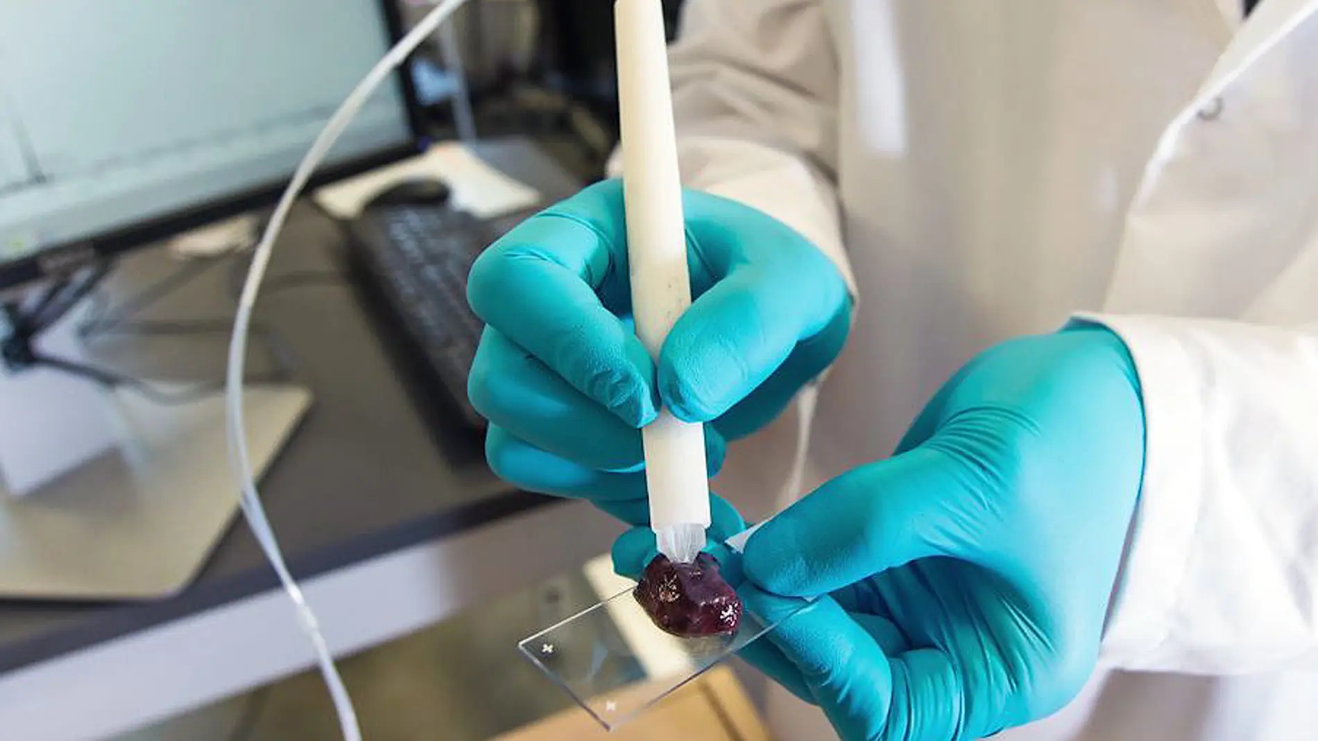 Un dispositivo identifica en segundos el tejido canceroso durante la cirugia