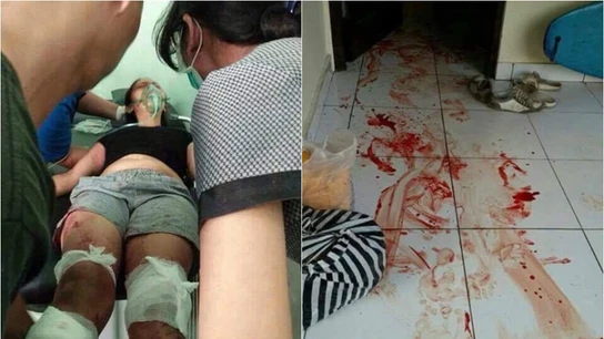 Un hombre le corta los pies a su mujer delante de sus hijos en Bali Un hombre le corta los pies a su mujer delante de sus hijos en Bali