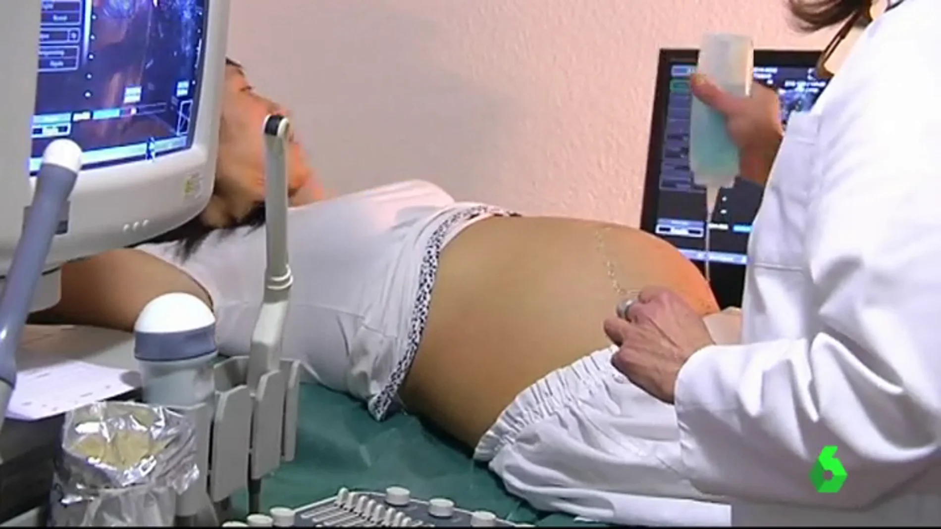 Una mujer embarazada durante una ecografía