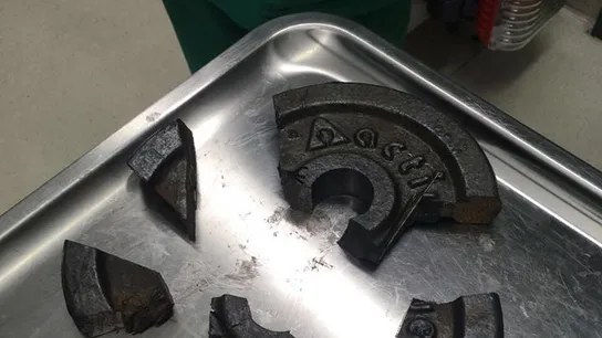 Restos del disco de pesos donde quedó atrapado el pene de un hombre Restos del disco de pesos donde quedó atrapado el pene de un hombre