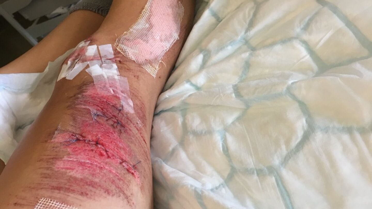 Lauren Dolan tras su ca&iacute;da en la carrera de contrarreloj