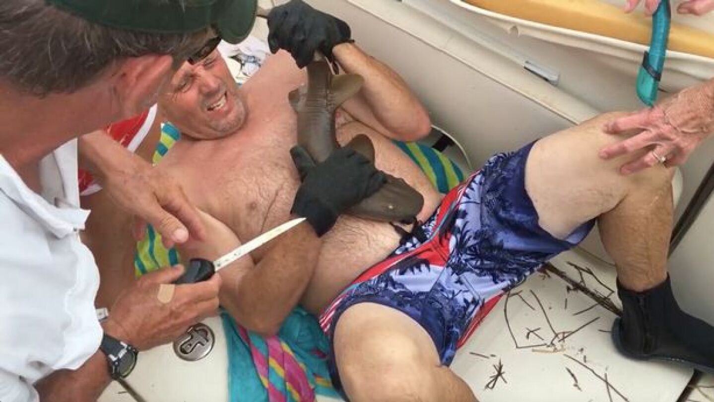 Tibur&oacute;n aferrado al abdomen de un hombre