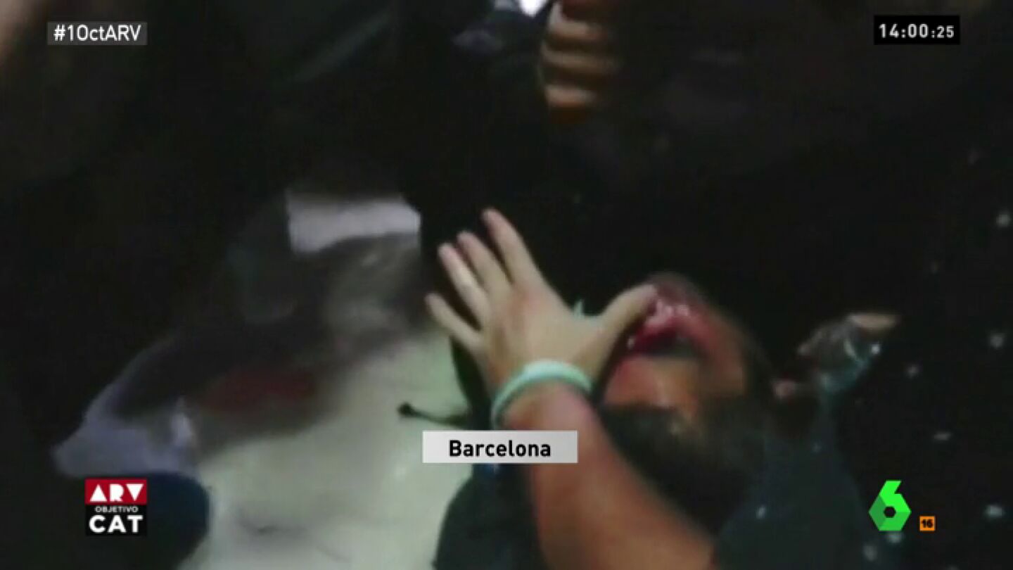 Herido en el ojo por una pelota de goma disparada por la Polic&iacute;a Nacional durante el 1-O