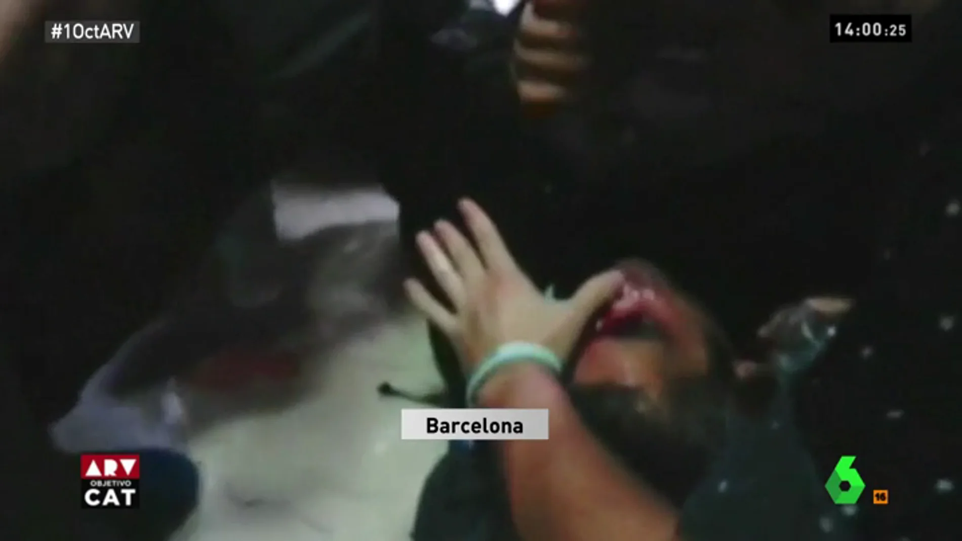 Herido en el ojo por una pelota de goma disparada por la Policía Nacional durante el 1-O