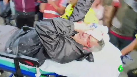 herido ojo herido ojo