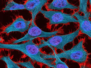 Los cultivos de células HeLa con estas constituyen el linaje de células humanas más antiguo Los cultivos de células HeLa con estas constituyen el linaje de células humanas más antiguo