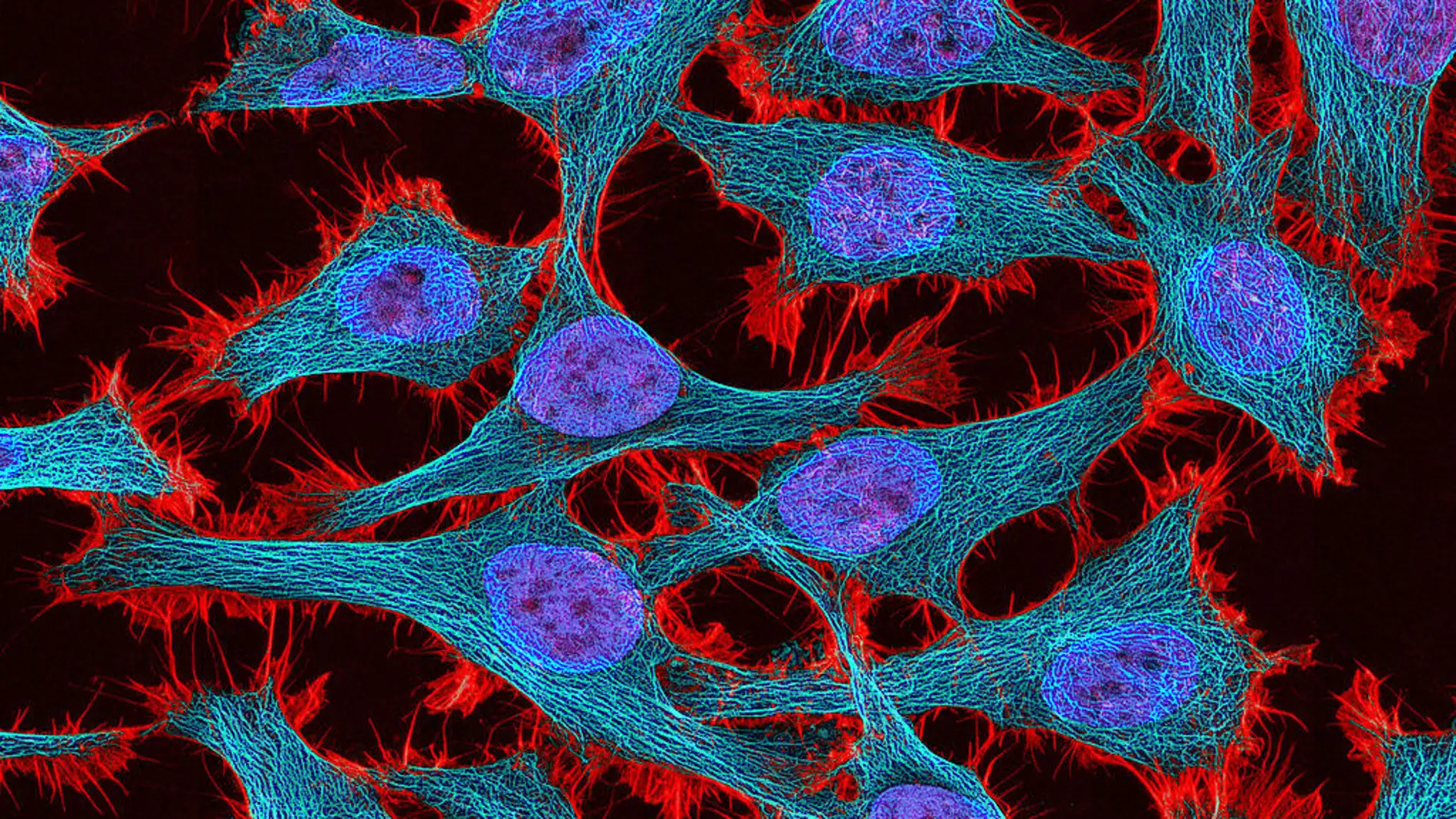Los cultivos de células HeLa con estas constituyen el linaje de células humanas más antiguo 