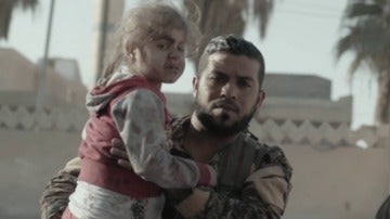 Un niña herida en Raqqa