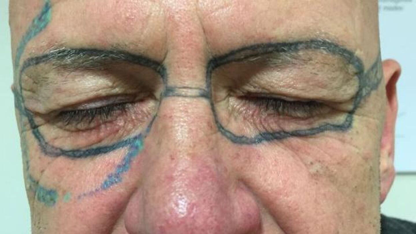 El hombre con las gafas tatuadas en la cara