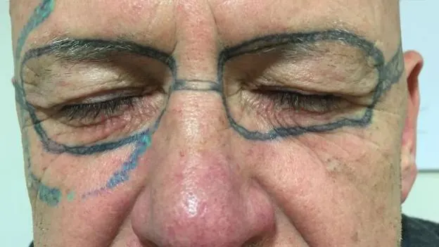 El hombre con las gafas tatuadas en la cara