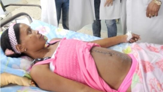 La mujer despu&eacute;s de extraerle el fibroma de 10 kilos.