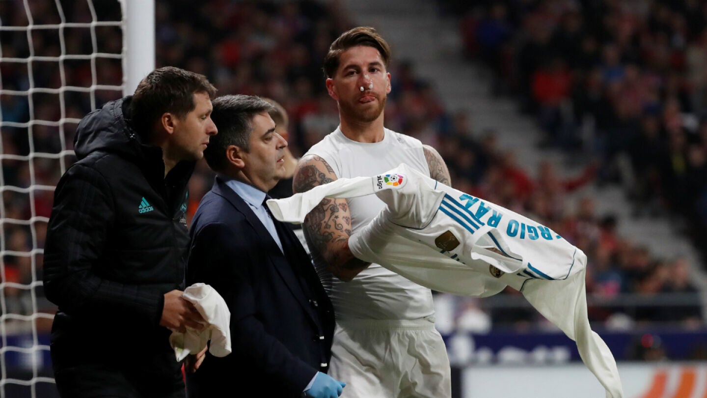 Sergio Ramos, con la nariz fracturada