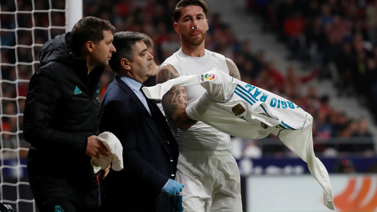 Sergio Ramos, con la nariz fracturada Sergio Ramos, con la nariz fracturada