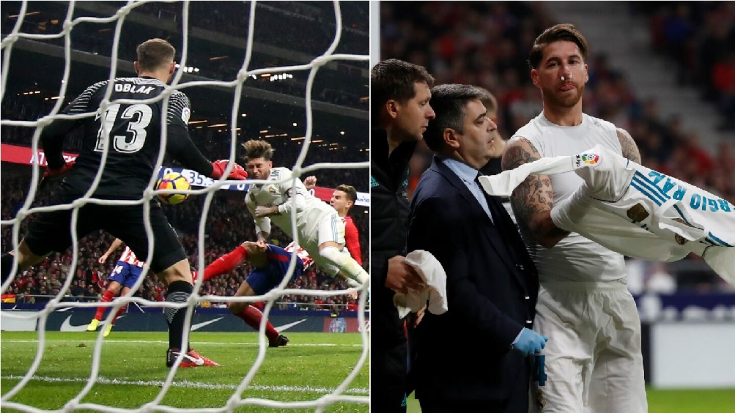 La jugada en la que Lucas rompi&oacute; la nariz a Sergio Ramos
