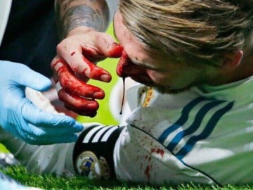 Sergio Ramos, sangrando Sergio Ramos, sangrando
