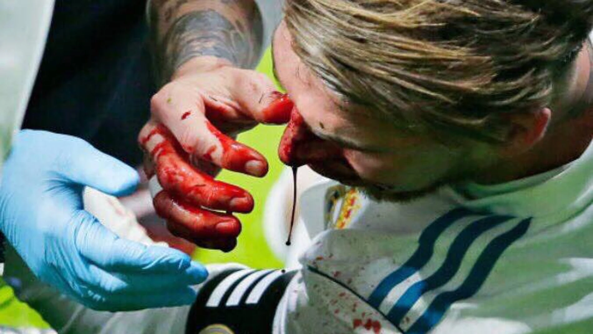 Sergio Ramos, sangrando