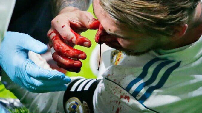 Sergio Ramos, sangrando Sergio Ramos, sangrando