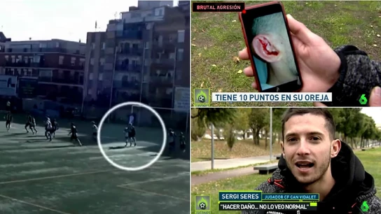 Agresión a un jugador de la primera catalana Agresión a un jugador de la primera catalana