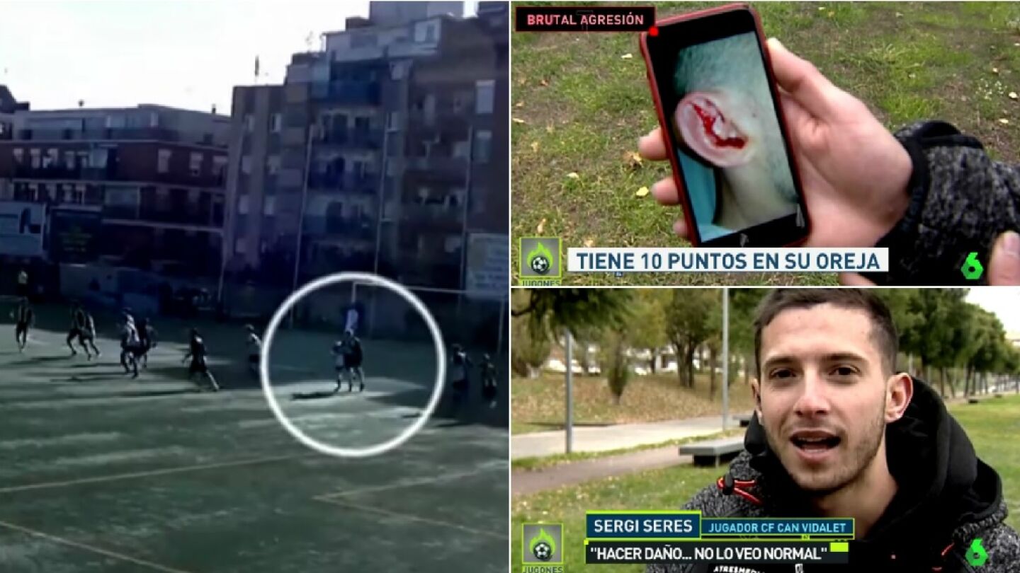 Agresi&oacute;n a un jugador de la primera catalana